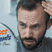 Top Hair Restoration Options for Men in South Jersey