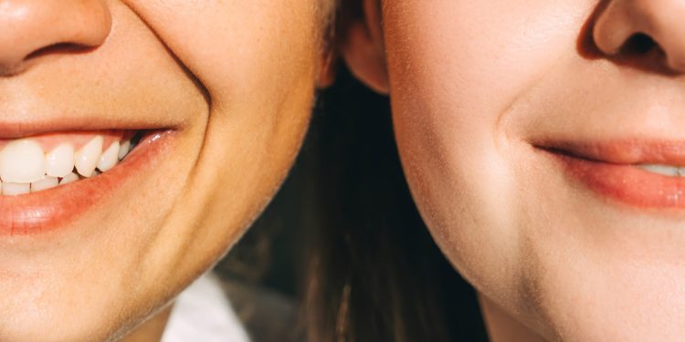 Best Treatments for Smile Lines, According to Dermatologists