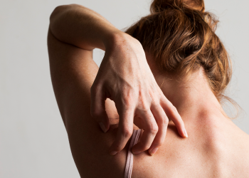 Dry Skin vs. Eczema: Dermatologists Explain the Difference