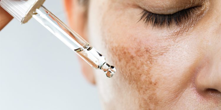 A Deep Dive Into the Frustrating World of Dark Spots