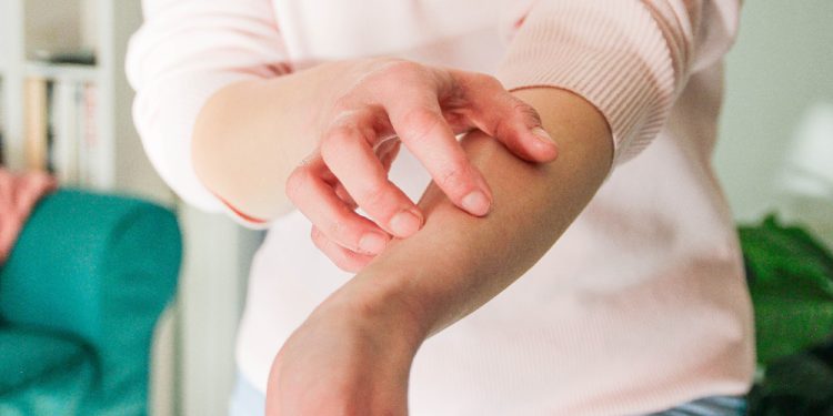 Causes, Symptoms, Triggers and Treatment