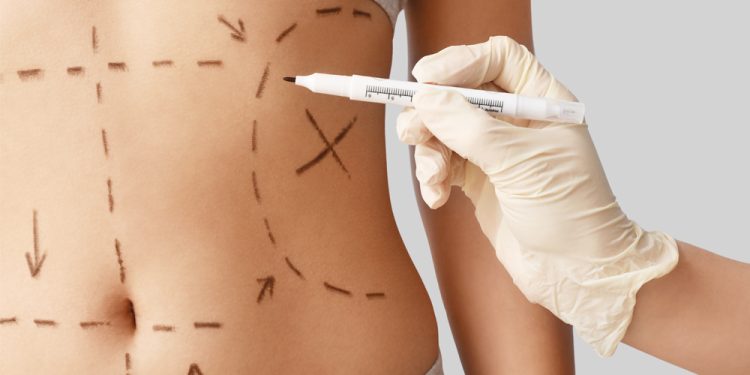 The Cosmetic Surgeries That Can Be Covered By Insurance