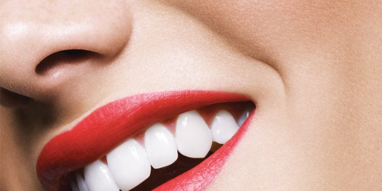 Is Teeth Whitening Ever Really Safe for Sensitive Teeth?