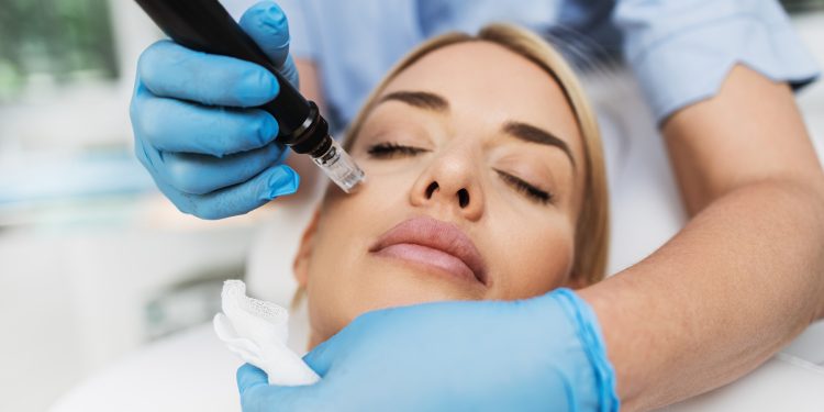 The Ultimate Guide to Skin Care After Microneedling