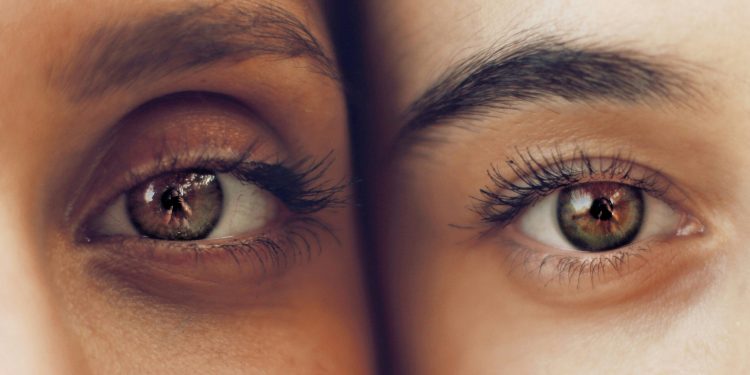 Can Weight Loss Make Eye Bags Worse?