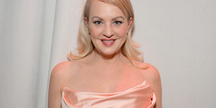 Wendi McLendon-Covey Reveals the Cosmetic Procedure That Kept Her From the ‘Bridesmaids’ Oscars Reunion