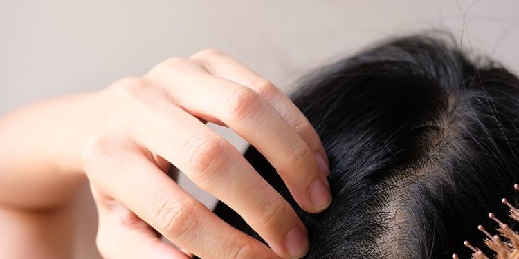 Dandruff or Skin Cancer? How to Tell the Difference on Your Scalp