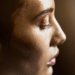 Radiesse May Be Tackling a Deeper Layer of Sun Damage, Study Finds