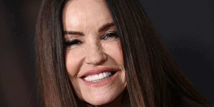 Janice Dickinson Reveals Deep Plane Facelift and Brow Lift Results at 71