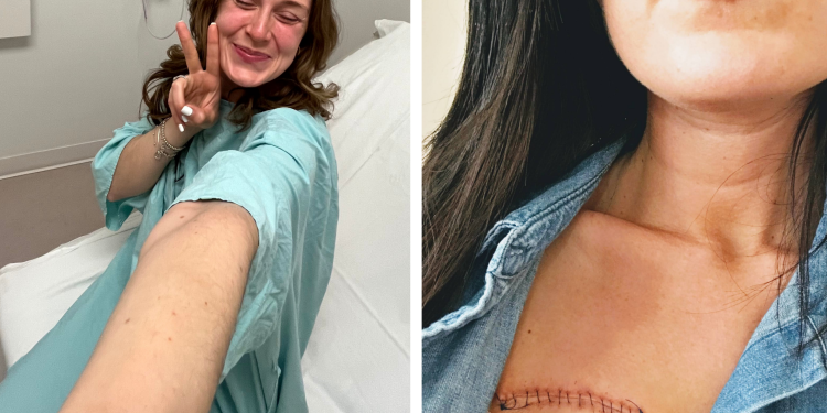 I Was 26 When Melanoma Changed Everything: A Survivor’s Story