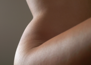 Why Plastic Surgeons Are Replacing Filler With Fat—From the Face Down