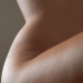 Why Plastic Surgeons Are Replacing Filler With Fat—From the Face Down