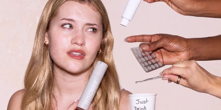 Isotretinoin, But Make It Topical: This Accutane Alternative Just Made Acne Care More Accessible