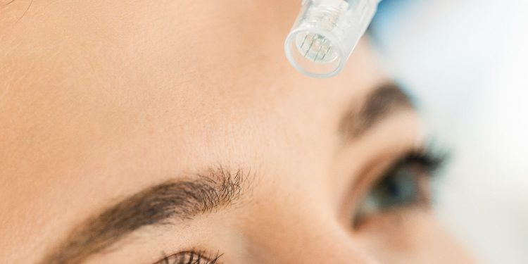 10 Celebrities Who Love Microneedling