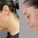 Inside the Rise of the 40-Something Facelift