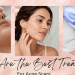 What Are the Best Treatments for Acne Scars?