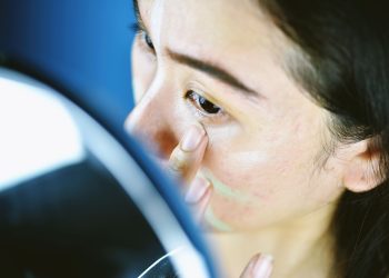 So You Think Your Makeup Is Acne-Safe?