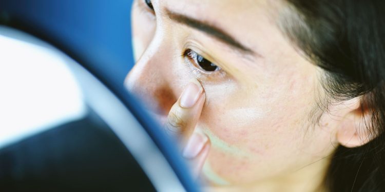 So You Think Your Makeup Is Acne-Safe?