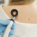 The Uncommon Signs of Skin Cancer Doctors Want You to Know