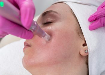 Is It Safe to Get Microneedling in the Summer? We Asked the Experts