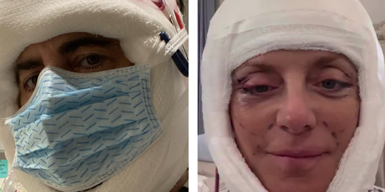 7 Celebrities Who Got Candid About Their Post-Procedure Recovery and Results