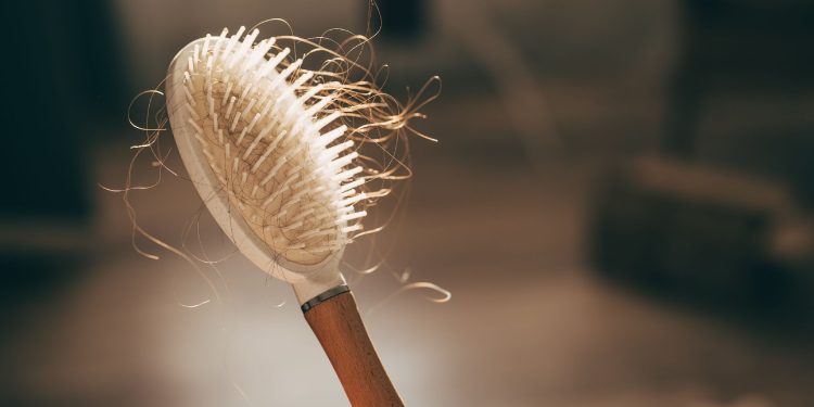 Women’s Hair Thinning Is More Complicated Than ‘Just Stress’