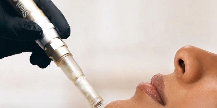This Microneedling Device Just Got FDA Clearance for Under-Eye Wrinkles